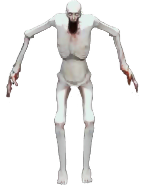 Scp 096