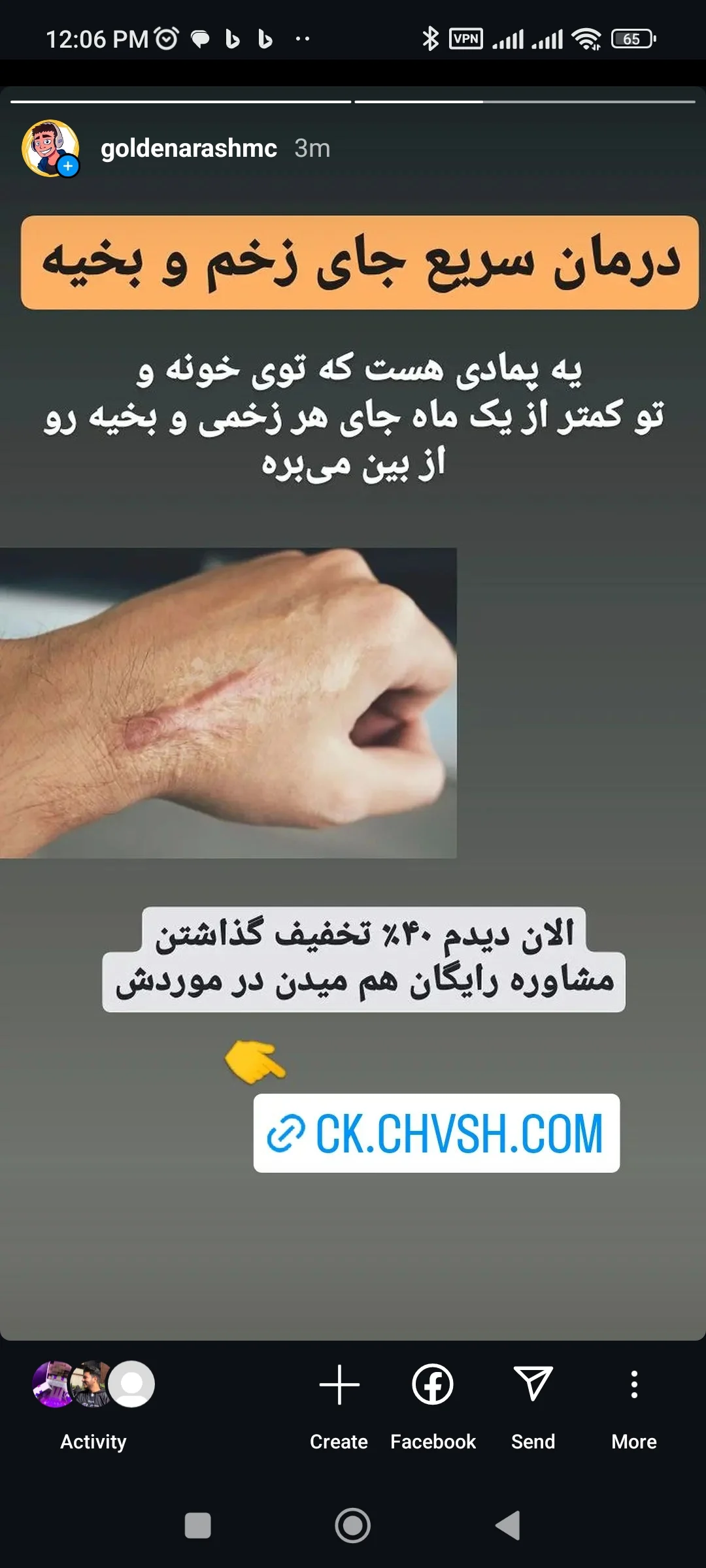 Ash12na