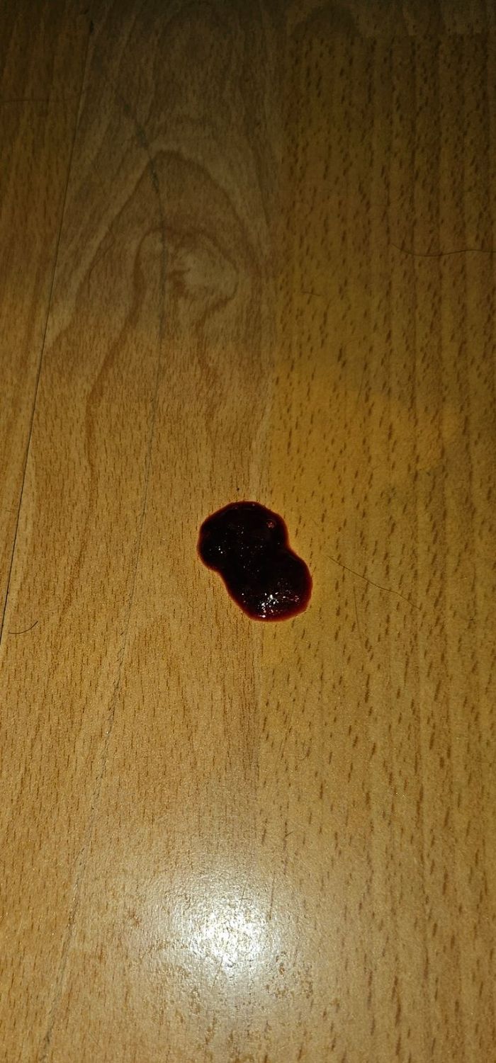 Köpke
