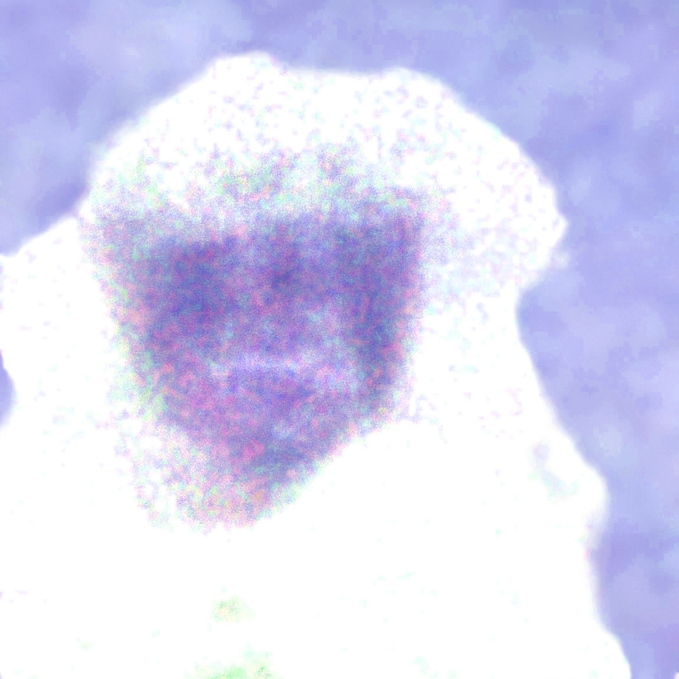 KT 