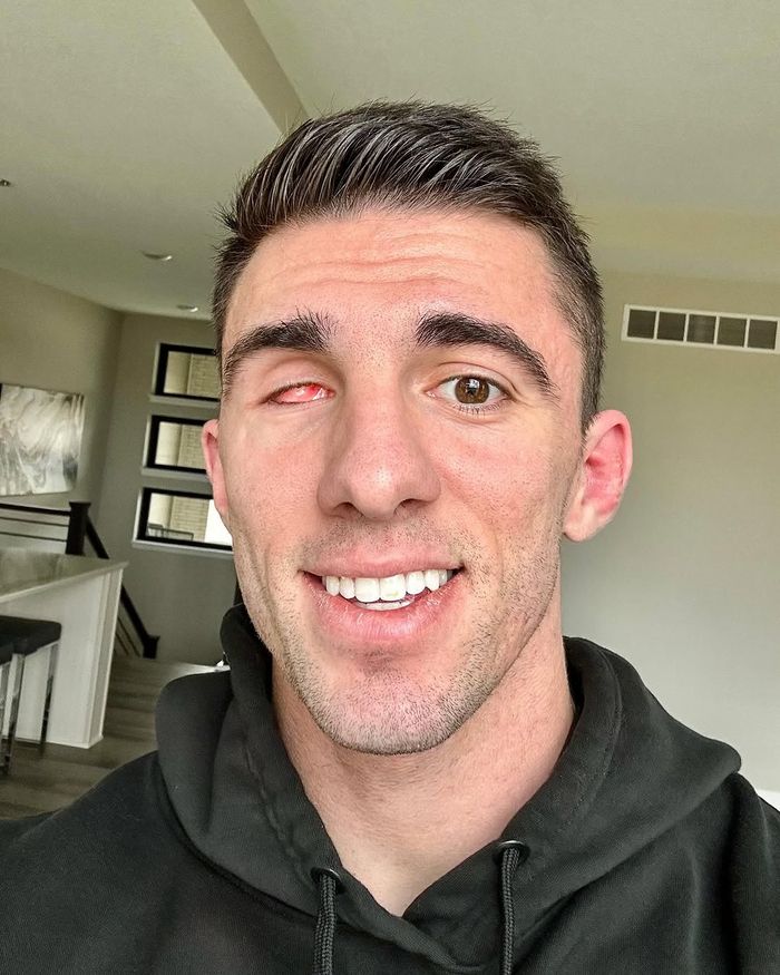 Jarrett Stod