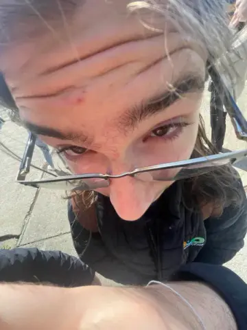 Error Test