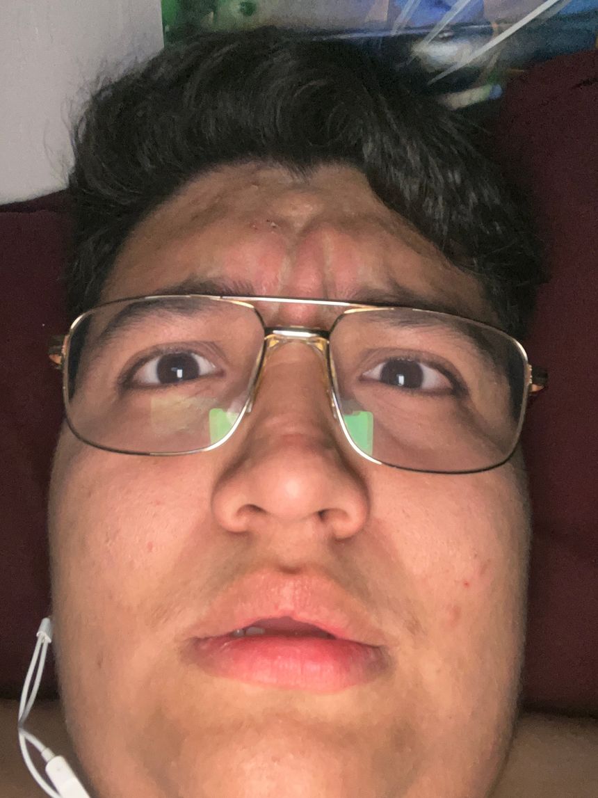 BB