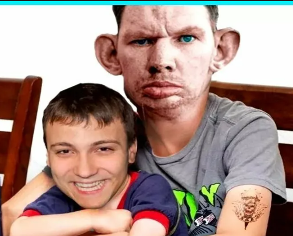 Пена мерси