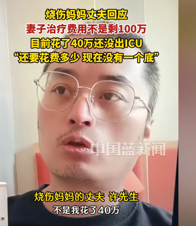 烧伤爸爸 