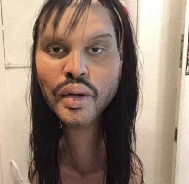 Simpkop